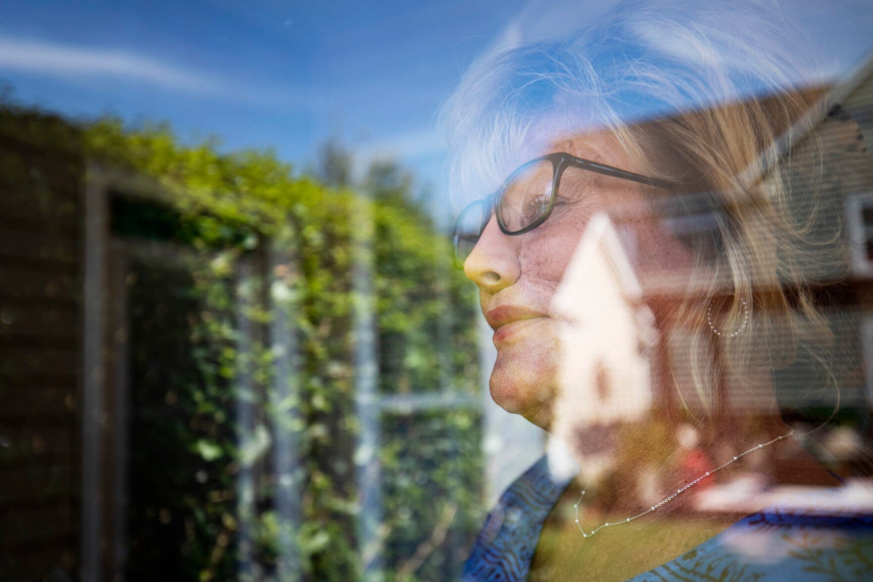 A rare disease destroyed her nose. After 10 years, she's finally leaving the house.